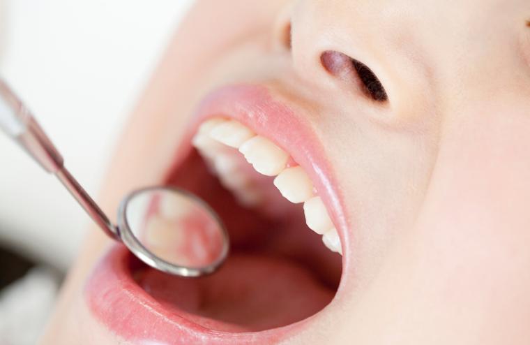 歯のクリーニングとは？期待できる効果と日々の歯磨きとの違いを解説